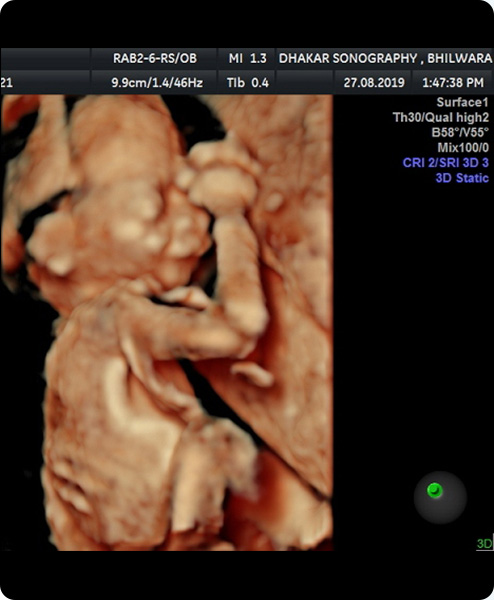 Dhakar Sonography About Us